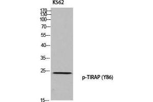 Western Blot (WB) analysis of K562 using p-TIRAP (Y86) antibody. (TIRAP Antikörper  (pTyr86))