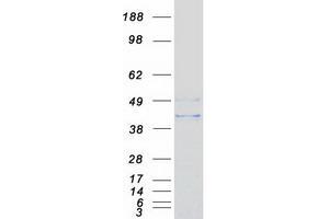 Western Blotting (WB) image for N-Acylsphingosine Amidohydrolase (Acid Ceramidase) 1 (ASAH1) (Transcript Variant 2) protein (Myc-DYKDDDDK Tag) (ABIN2714319)