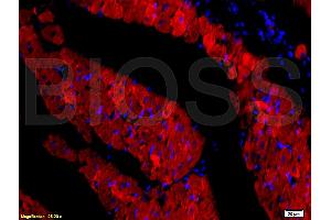 Formalin-fixed and paraffin embedded rat heart tissue labeled with Rabbit Anti-DOG-1/TMEM16A Polyclonal Antibody, Unconjugated (ABIN704216) at 1:200 followed by conjugation to the secondary antibody and DAB staining. (ANO1 Antikörper  (AA 151-250))