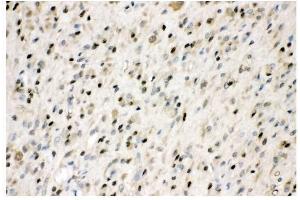 IHC analysis of VCP using anti-VCP antibody (ABIN3043958).