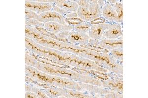 Immunohistochemistry of paraffin-embedded mouse kidney using Na+/K+-ATPase Rabbit pAb (ABIN6133568, ABIN6137299, ABIN6137301 and ABIN6223860) at dilution of 1:50 (40x lens).