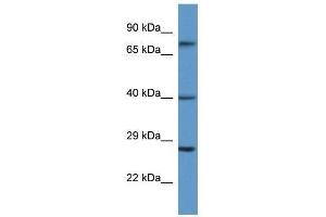 Western Blot showing AGTR2 antibody used at a concentration of 1. (Angiotensin II Type 2 Receptor Antikörper  (N-Term))