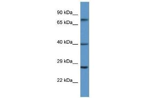 Western Blot showing AGTR2 antibody used at a concentration of 1.