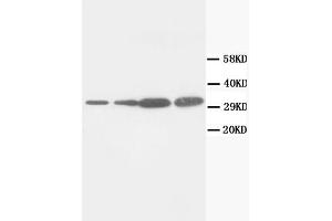 Western Blotting (WB) image for anti-Proliferating Cell Nuclear Antigen (PCNA) antibody (ABIN1108598) (PCNA Antikörper)