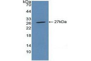Western blot analysis of recombinant Mouse CLEC10A. (CLEC10A Antikörper  (AA 69-273))
