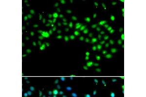Immunofluorescence analysis of MCF-7 cells using SRSF4 Polyclonal Antibody (SRSF4 Antikörper)