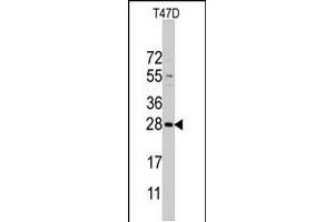 Western blot analysis of PEMT polyclonal antibody  in T-47D cell line lysates (35 ug/lane). (PEMT Antikörper  (C-Term))