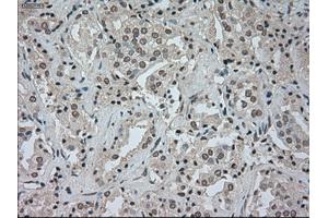 Image no. 2 for anti-Cancer/testis Antigen 1B (CTAG1B) antibody (ABIN1499899) (CTAG1B Antikörper)