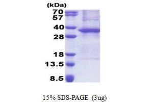 Ankyrin Repeat and SOCS Box Containing 8 (ASB8) (AA 1-288) protein (His tag)