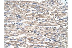 BMP2K antibody was used for immunohistochemistry at a concentration of 4-8 ug/ml.