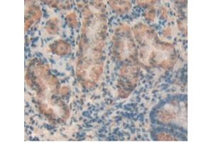 Immunohistochemistry (IHC) image for anti-T Cell Immunoreceptor with Ig and ITIM Domains (TIGIT) (AA 21-234) antibody (ABIN7439486)
