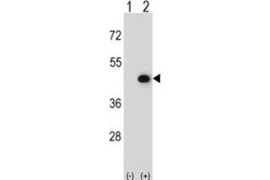 Western Blotting (WB) image for anti-Creatine Kinase, Mitochondrial 2 (Sarcomeric) (CKMT2) antibody (ABIN3002972)
