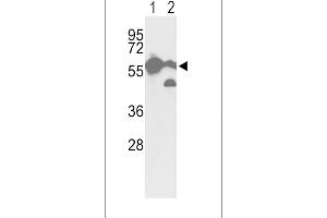 Western blot analysis of hPKM2-N491 in A2058 cell line(lane 1) and mouse brain tissue(lane 2) lysates (35ug/lane) (Pyruvate Kinase Antikörper  (C-Term))
