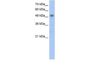WB Suggested Anti-RSAD2 Antibody Titration:  5. (RSAD2 Antikörper  (C-Term))