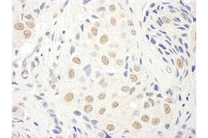 Immunohistochemistry (IHC) image for anti-Transcription Elongation Factor A (SII), 3 (TCEA3) (AA 1-50) antibody (ABIN7453526)