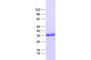 Western Blotting (WB) image for GATA Zinc Finger Domain Containing 1 (GATAD1) protein (His tag) (ABIN2721741)