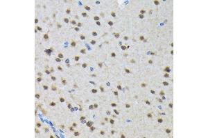 Immunohistochemistry of paraffin-embedded rat brain using SMN1 Rabbit mAb (ABIN7270651) at dilution of 1:100 (40x lens).