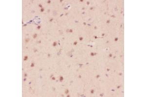 Anti-Crk p38 Picoband antibody,  IHC(P): Rat Brain Tissue