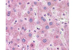 ApoB antibody was used for immunohistochemistry at a concentration of 4-8 ug/ml. (APOB Antikörper  (Middle Region))