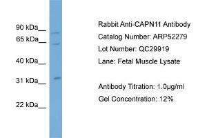 WB Suggested Anti-CAPN11  Antibody Titration: 0.