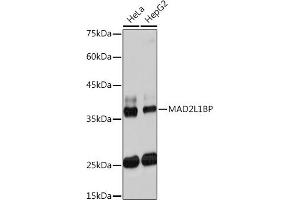 Western blot analysis of extracts of various cell lines, using ML1BP Rabbit mAb (ABIN7268357) at 1:1000 dilution. (MAD2L1BP Antikörper)