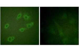 Immunofluorescence analysis of HuvEc cells, using HER3 (Phospho-Tyr1222) Antibody. (ERBB3 Antikörper  (pTyr1222))