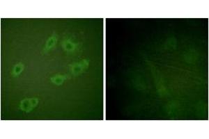 Immunofluorescence analysis of HuvEc cells, using HER3 (Phospho-Tyr1222) Antibody.