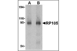 Western blot analysis of RP105 in human spleen tissue lysate with this product at (A) 0. (CD180 Antikörper  (C-Term))