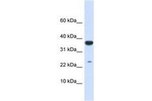 Image no. 1 for anti-Ubiquitin-Conjugating Enzyme E2D 2 (UBE2D2) (AA 36-85) antibody (ABIN6743144) (UBE2D2 Antikörper  (AA 36-85))