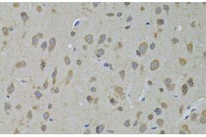Immunohistochemistry of paraffin-embedded Rat brain using ADH5 Polyclonal Antibody at dilution of 1:100 (40x lens). (ADH5 Antikörper)