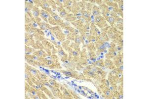 Immunohistochemistry of paraffin-embedded mouse heart using GLRX3 antibody at dilution of 1:100 (x40 lens).