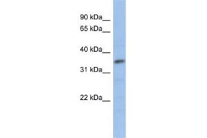 WB Suggested Anti-MYF5 Antibody   Titration: 1 ug/ml   Positive Control: Human Jurkat Cell (MYF5 Antikörper  (N-Term))
