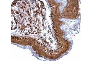 IHC-P Image ERCC2 antibody [N2C2], Internal detects ERCC2 protein at cytosol and nucleus on mouse esophagus by immunohistochemical analysis. (ERCC2 Antikörper  (Internal Region))