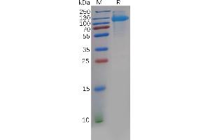 SDS-PAGE (SDS) image for CUB Domain Containing Protein 1 (CDCP1) (AA 30-667) protein (His tag) (ABIN7092759)