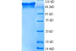 SDS-PAGE (SDS) image for Folate Hydrolase (Prostate-Specific Membrane Antigen) 1 (FOLH1) (AA 48-750), (partial) protein (His tag) (ABIN5712794)