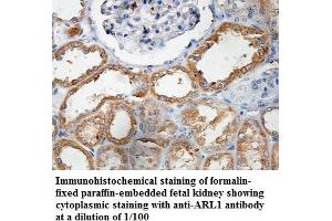 Image no. 1 for anti-ADP Ribosylation Factor Like GTPase 1 (ARL1) antibody (ABIN1574817) (ARL1 Antikörper)