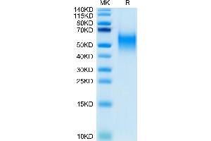 Biotinylated Human B7-1 on Tris-Bis PAGE under reduced condition. (CD80 Protein (CD80) (AA 35-242) (His-Avi Tag,Biotin))