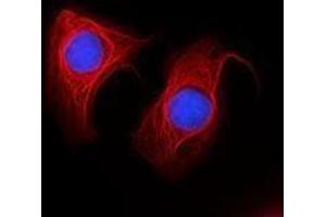 Immunofluorescence (IF) image for anti-Keratin 18 (KRT18) antibody (Alexa Fluor 647) (ABIN2657197) (Cytokeratin 18 Antikörper  (Alexa Fluor 647))