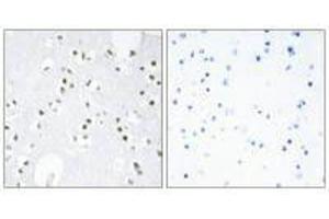 Immunohistochemistry analysis of paraffin-embedded human brain tissue, using c-Jun (Ab-243) antibody.