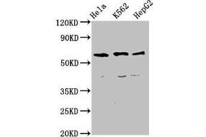 Western Blot Positive WB detected in: Hela whole cell lysate, K562 whole cell lysate, HepG2 whole cell lysate All lanes: CCT5 antibody at 4 μg/mL Secondary Goat polyclonal to rabbit IgG at 1/50000 dilution Predicted band size: 60, 50 kDa Observed band size: 60 kDa (CCT5 Antikörper  (AA 1-270))