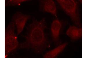 Immunofluorescence staining of methanol-fixed HeLa cells using Phospho-NF2-S518 antibody (ABIN2988202). (Merlin Antikörper  (pSer518))