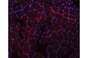 IF analysis of CAV3 using anti-CAV3 antibody (ABIN6719285).