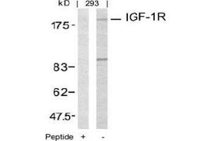 Image no. 3 for anti-Insulin-Like Growth Factor 1 Receptor (IGF1R) (Tyr1161) antibody (ABIN197243) (IGF1R Antikörper  (Tyr1161))