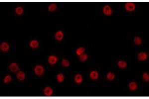 ABIN6266705 staining HuvEc by IF/ICC. (ANP32C Antikörper  (Internal Region))