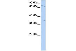 WB Suggested Anti-ZNF224 Antibody Titration:  0. (ZNF224 Antikörper  (Middle Region))