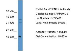 WB Suggested Anti-PSENEN  Antibody Titration: 0. (PEN2 Antikörper  (C-Term))