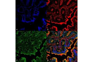 Immunohistochemistry analysis using Rabbit Anti-NHE3 Polyclonal Antibody (ABIN2486551). (SLC9A3 Antikörper  (PE))