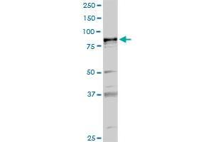 PLA2G6 MaxPab rabbit polyclonal antibody. (PLA2G6 Antikörper  (AA 1-752))