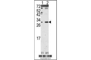 Western blot analysis of DKK2 using DKK2 Antibody using 293 cell lysates (2 ug/lane) either nontransfected (Lane 1) or transiently transfected with the DKK2 gene (Lane 2). (DKK2 Antikörper  (N-Term))