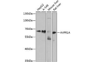 Western blot analysis of extracts of various cell lines, using A antibody (ABIN6129944, ABIN6137377, ABIN6137378 and ABIN6224448) at 1:1000 dilution. (AVPR1A Antikörper  (AA 349-418))